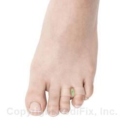 Visco-GEL® Customizables® Little ToeBuddy® (#1035-CTZ)