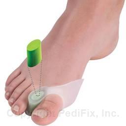 Visco-GEL® Customizables® Dual-Action Bunion Fix™ (#1315-CTZ)