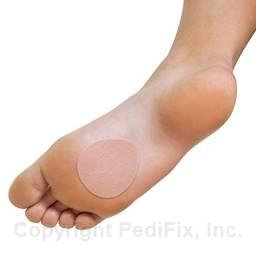 FELTastic® Metatarsal Pads (#8501/8502)