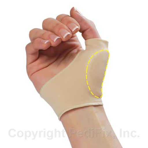 Visco-GEL® CMC/MP Joint Protector